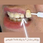 مطب دندانپزشکی دکتر سیده زهرا پسته ای