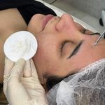فشیال تخصصی در کلینیک پوست مو ونوس