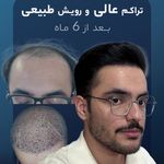 کلینیک پوست و کاشت مو ارغوان