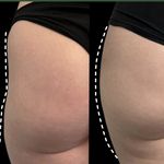 کلینیک لیزر  کندلاوزیبایی پوست ومو آیشیل