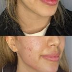 مطب زیبایی آرا