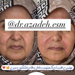 کلینیک زیبایی و لیزر دکتر آزاده اسماعیلی