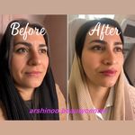 کلینیک لیزر و پوست و مو و زیبایی آرشینو