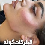 کلینیک زیبایی، پوست و مو نچرال بیوتی