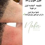 کلینیک زیبایی و لیزر مو زائد نوبا