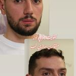 کلینیک زیبایی پوست و لیزر آلن