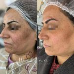 مطب  دکتر ملینا پورکاظمی