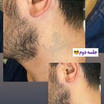 کلینیک پوست،مو،زیبایی،مرکز لیزر ‌پرنسا