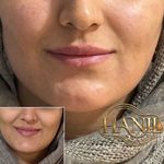 کلینیک زیبایی هانیل