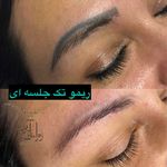 مركز تخصصي ابرو زرکاشت