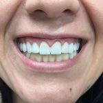 مطب ایمپلنت دکتر نیما شفیعی