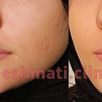 کلینیک پوست مو زیبایی دکتر حشمتی