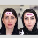 کلینیک پوست و زیبایی ژیلاوَش