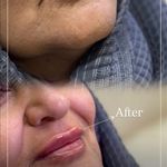 کیلینیک زیبایی و لیزر ژامک