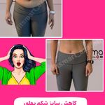 مرکز لاغری موضعی و ایکس بادی فیت اسمارت