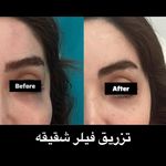 مرکز پوست،مو وزیبایی دکتر فرنوش میلانی