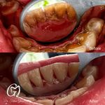مطب دندانپزشکی دکتر فاطمه قانعی گلبهار