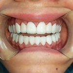 مطب ایمپلنت دکتر نیما شفیعی