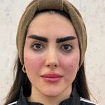 کلینیک پوست سلین - کلینیک پوست و مو - شهر شیراز - 0030