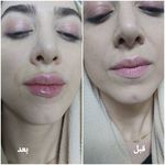 کلینیک زیبایی و لیزر مو گندم شرق تهران