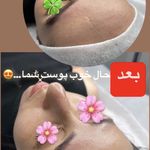فشیال و اسکراب اسکالپ کلینیک بلا