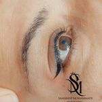 مرکز تخصصی میکروبلیدینگ فیبروز ریموو تخصصی