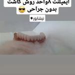 دندانپزشکی ایمپلنت و کلیه خدمات