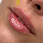 کلینیک پوست،زیبایی ولیزر اِلی(کندلا2025)