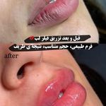 مرکز لیزر و کلینیک زیبایی پریفا
