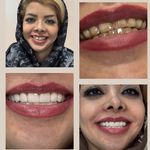 کلینیک تخصصی دندانپزشکی و ایمپلنت الین