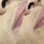 اصلاح تخصصی ابرو و صورت قیطریه