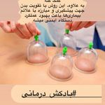 اولین مرکز تخصصی حجامت در شرق تهران(یاس)
