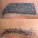 میکروبلیدینگ میناسلمانی