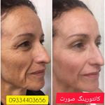 دکتر نیلوفر سلیمانی پوست و مو و زیبایی