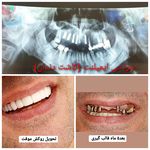 دندانپزشکی دکتر شیرزاد ویسی