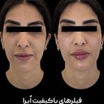 مطب زیبایی دکتر نشاط