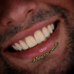 دندانپزشکی و ایمپلنت دکتر مهدی کریمی