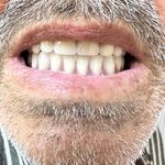 دندانسازی داود یارمحمدی