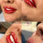 فیبروز ابرو شیدینگ لب بشردوست