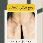 کلینیک زیبایی و مرکز لیزر هانیسا