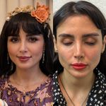 کلینیک زیبایی بلک ساوه