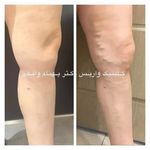 کلینیک تخصصی درمان واریس دکتر واقفی