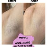 مرکز تخصصی لیزر مِدورا