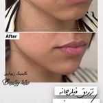 کلینیک پوست و مو و لیزر نیلوفر آبی