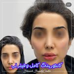 کلینیک پوست و مو بلانژ