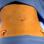 جراحی زیبایی آپادانا