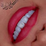 مطب دندانپزشکی زیبایی دکتر مانديس صدر