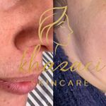 فیشال و پاکسازی پوست درنواب