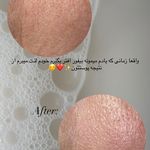 مرکز پاکسازی و پلاژن تراپی سیلکی فیشال
