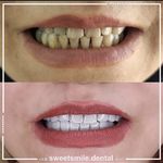 مطب دندان پزشکی لبخند شیرین